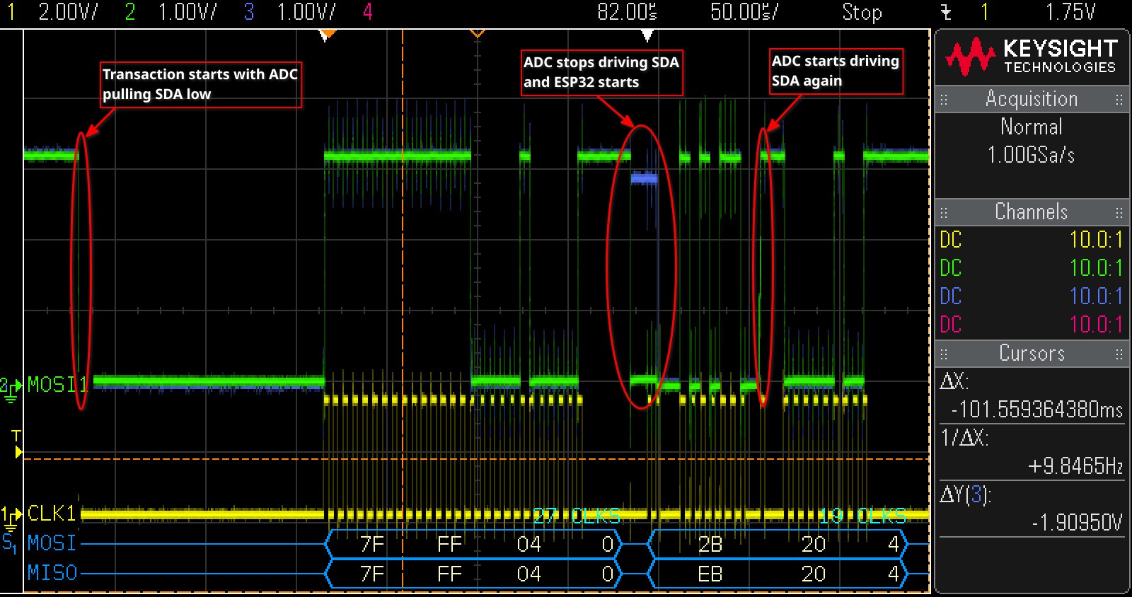 Oscilloscope trace capture of single thermocouple ADC transaction. Green trace ESP32 side of R105, blue trace ADC side of R105.